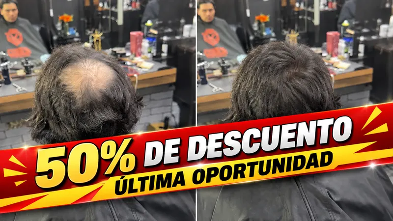 Antes y después de una pieza parcial confeccionada a medida para una falla localizada, con 50% de descuento por última oportunidad